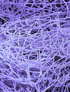 Nobile studies biofilms like the Candida albicans, shown in this scanning electron micrograph.